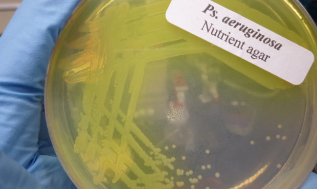 Pseudomonas aeruginosa culture | Sun14916 Wikimedia Commons...