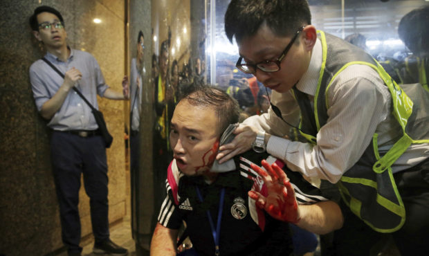 District councilor Andrew Chiu receives medical treatment in Hong Kong, on Sunday, Nov. 3, 2019. Ri...