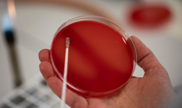 File photo: February 11, 2019. The CDC says several people in Utah are showing symptoms of a germ t...