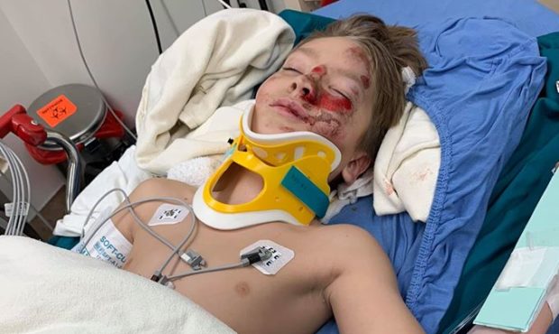 payson hit and run...