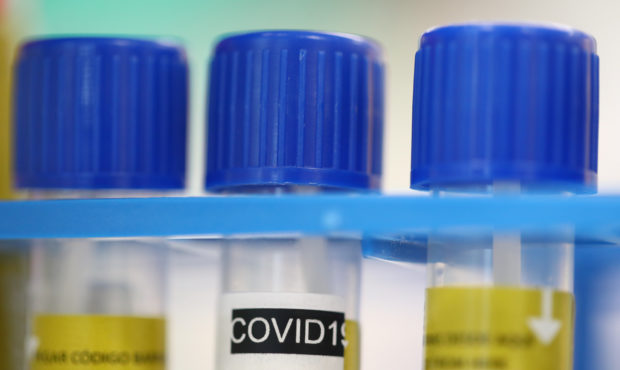 doctor antibody testing...