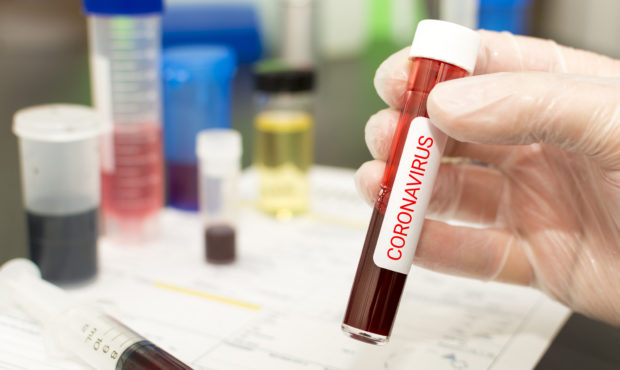 CPAC attendee tested positive for coronavirus...