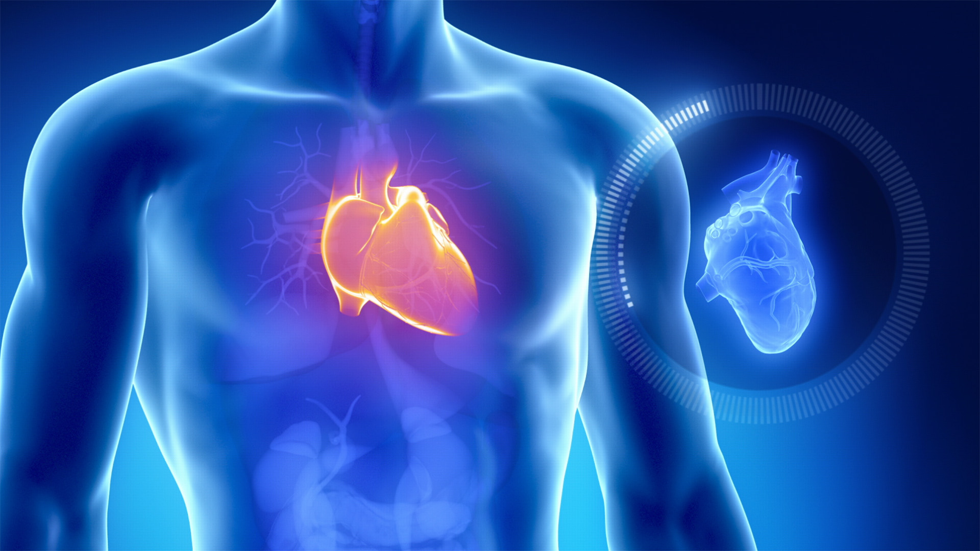(CNN) -- There's growing evidence that Black heart failure patients are less likely to get advanced...